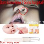 Baby-Dig-Booger-Clip-Infants-Clean-Ear-Nose-Navel-Safety-Tweezers-Safe-Forceps-Cleaning-Supplies-Safety
